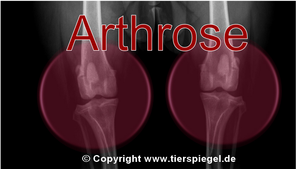 Arthrose 4