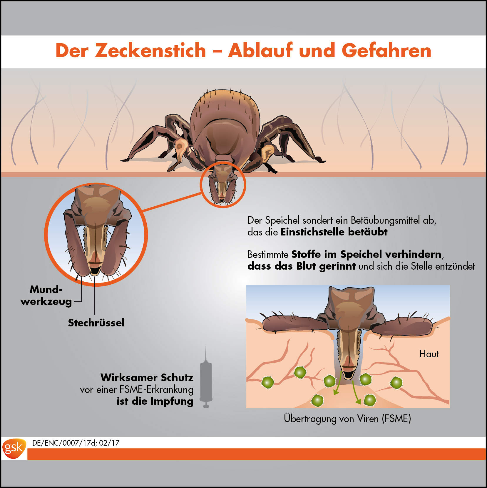 FSME Infografik Zeckenstich